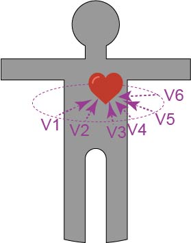 derivations precordiales