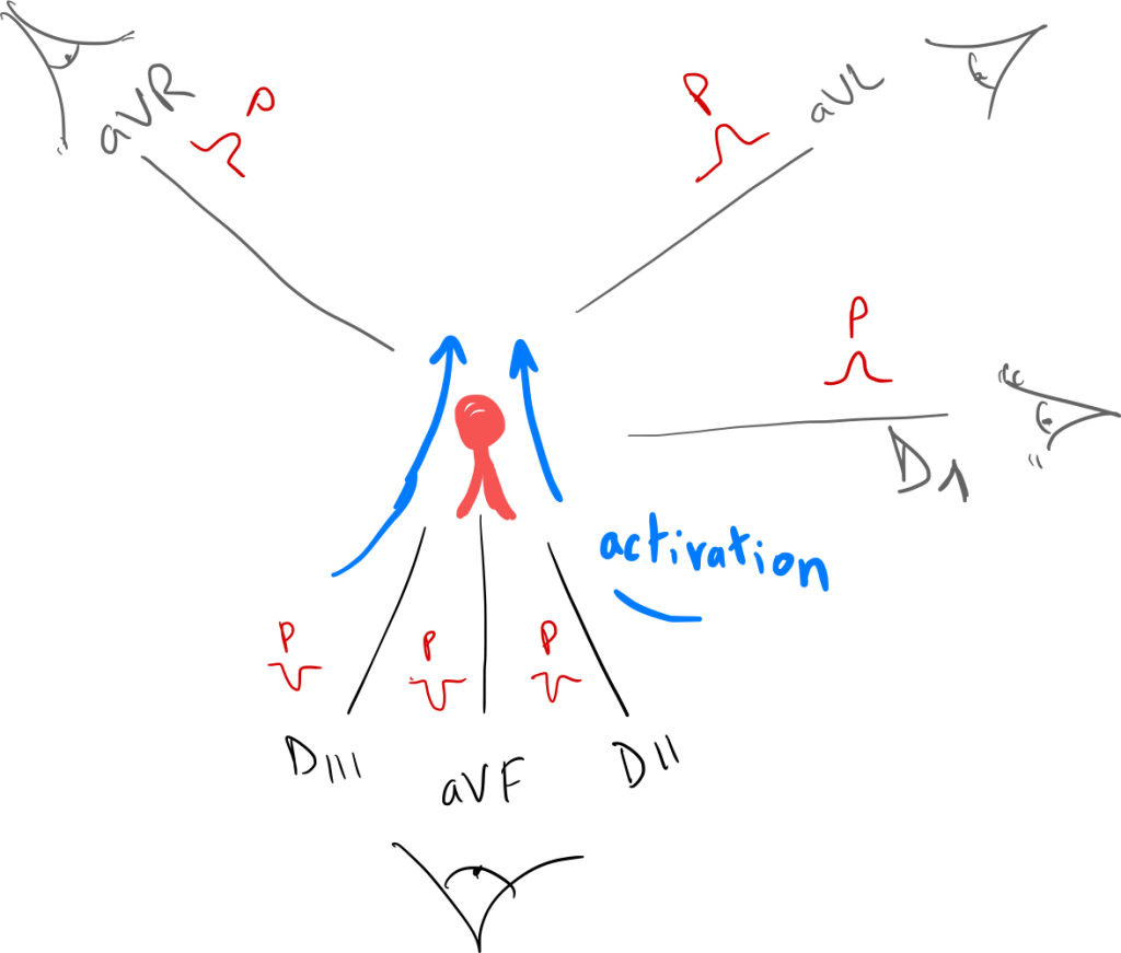 Astuce de l'œil pour comprendre la polarité de l'onde P rétrograde.